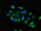 C-C chemokine receptor type 10 antibody, CSB-PA004840LA01HU, Cusabio, Immunofluorescence image 