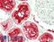 CD13 antibody, LS-B14307, Lifespan Biosciences, Immunohistochemistry paraffin image 