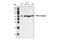 Protein Phosphatase 2 Scaffold Subunit Aalpha antibody, 2039S, Cell Signaling Technology, Western Blot image 