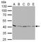 Protein Arginine Methyltransferase 1 antibody, GTX630187, GeneTex, Western Blot image 