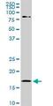 Cofilin 1 antibody, ab54532, Abcam, Western Blot image 