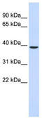 TRNA-YW Synthesizing Protein 5 antibody, TA339898, Origene, Western Blot image 