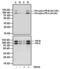 Progesterone Receptor antibody, GTX30164, GeneTex, Western Blot image 