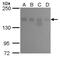 Lysine Demethylase 6A antibody, GTX630412, GeneTex, Western Blot image 