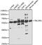 Transducin Beta Like 1 X-Linked Receptor 1 antibody, 23-215, ProSci, Western Blot image 