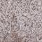 TRNA Methyltransferase Subunit 11-2 antibody, NBP1-92008, Novus Biologicals, Immunohistochemistry frozen image 