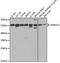 Annexin A11 antibody, GTX33010, GeneTex, Western Blot image 