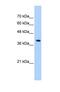 Peroxisomal Biogenesis Factor 10 antibody, NBP1-59745, Novus Biologicals, Western Blot image 