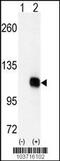Diacylglycerol Kinase Zeta antibody, 63-371, ProSci, Western Blot image 