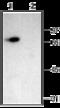 Acid Sensing Ion Channel Subunit 2 antibody, GTX54802, GeneTex, Western Blot image 