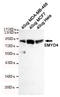 SET And MYND Domain Containing 4 antibody, M14482, Boster Biological Technology, Western Blot image 