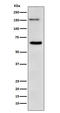 Nucleoporin 153 antibody, M02183, Boster Biological Technology, Western Blot image 