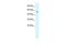 Potassium Two Pore Domain Channel Subfamily K Member 10 antibody, GTX47659, GeneTex, Western Blot image 