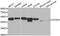 Ataxin 3 antibody, A12992, ABclonal Technology, Western Blot image 