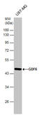 Growth Differentiation Factor 6 antibody, GTX131252, GeneTex, Western Blot image 