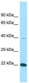 Acidic fibroblast growth factor intracellular-binding protein antibody, TA331203, Origene, Western Blot image 