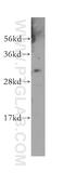Leukocyte Receptor Cluster Member 1 antibody, 11406-1-AP, Proteintech Group, Western Blot image 