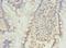 Programmed Cell Death 1 antibody, LS-C377503, Lifespan Biosciences, Immunohistochemistry paraffin image 