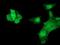 Heat Shock Protein Family B (Small) Member 7 antibody, NBP2-02666, Novus Biologicals, Immunocytochemistry image 