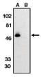 C-X3-C Motif Chemokine Receptor 1 antibody, AP05103PU-N, Origene, Western Blot image 