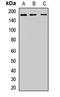 TLR4 Interactor With Leucine Rich Repeats antibody, LS-C668337, Lifespan Biosciences, Western Blot image 