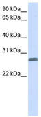 Transmembrane Protein 51 antibody, TA342352, Origene, Western Blot image 