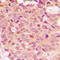 Histone Deacetylase 5 antibody, LS-C353224, Lifespan Biosciences, Immunohistochemistry frozen image 