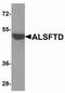 C9orf72-SMCR8 Complex Subunit antibody, NBP2-82070, Novus Biologicals, Western Blot image 