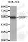 Cleavage And Polyadenylation Specific Factor 7 antibody, A3691, ABclonal Technology, Western Blot image 