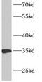 Ankyrin Repeat Domain 54 antibody, FNab00417, FineTest, Western Blot image 