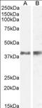 Interleukin 12B antibody, NB100-93409, Novus Biologicals, Western Blot image 