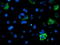 Acyl-CoA Synthetase Medium Chain Family Member 5 antibody, TA504441, Origene, Immunofluorescence image 