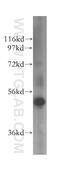 Aldehyde Dehydrogenase 5 Family Member A1 antibody, 17319-1-AP, Proteintech Group, Western Blot image 