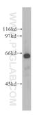 Cell Division Cycle 14A antibody, 13660-1-AP, Proteintech Group, Western Blot image 