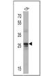 CD81 Molecule antibody, MA5-13548, Invitrogen Antibodies, Western Blot image 