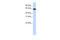 Nuclear Receptor Subfamily 2 Group C Member 2 antibody, 25-422, ProSci, Western Blot image 