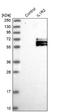Interleukin 1 Receptor Type 2 antibody, NBP1-86550, Novus Biologicals, Western Blot image 