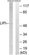 Lipase I antibody, GTX87435, GeneTex, Western Blot image 