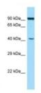 ADP-ribosylation factor-like protein 6-interacting protein 2 antibody, NBP1-98394, Novus Biologicals, Western Blot image 