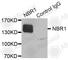 NBR1 Autophagy Cargo Receptor antibody, A3949, ABclonal Technology, Immunoprecipitation image 