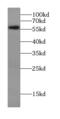 Chaperonin Containing TCP1 Subunit 6A antibody, FNab01401, FineTest, Western Blot image 