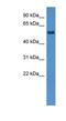 ALG8 Alpha-1,3-Glucosyltransferase antibody, NBP1-69028, Novus Biologicals, Western Blot image 