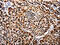 APAF1 Interacting Protein antibody, CSB-PA921015, Cusabio, Immunohistochemistry paraffin image 