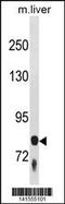 Coagulation Factor XIII B Chain antibody, 60-904, ProSci, Western Blot image 