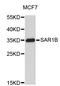 Secretion Associated Ras Related GTPase 1B antibody, STJ26819, St John
