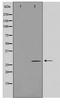 Lecithin retinol acyltransferase antibody, TA347620, Origene, Western Blot image 