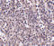 Epstein-Barr Virus Induced 3 antibody, 4977, ProSci, Immunohistochemistry paraffin image 