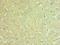 Nicotinamide Phosphoribosyltransferase antibody, LS-C376212, Lifespan Biosciences, Immunohistochemistry paraffin image 