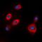 Tryptophan Hydroxylase 1 antibody, orb338838, Biorbyt, Immunofluorescence image 