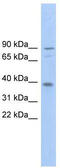 Transmembrane Channel Like 8 antibody, TA338861, Origene, Western Blot image 